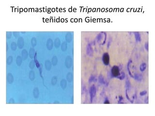 Tripomastigotes de Tripanosoma cruzi,
        teñidos con Giemsa.
 
