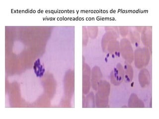 Extendido de esquizontes y merozoitos de Plasmodium
            vivax coloreados con Giemsa.
 