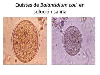 Quistes de Balantidium coli en
        solución salina
 