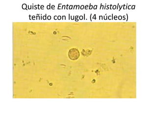 Quiste de Entamoeba histolytica
 teñido con lugol. (4 núcleos)
 