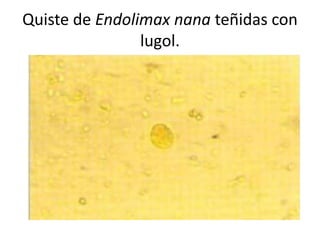 Quiste de Endolimax nana teñidas con
                lugol.
 