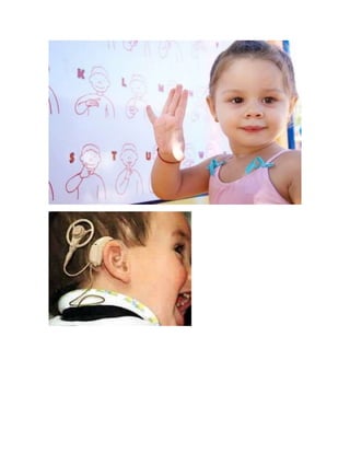 imágenes de niños sordos 