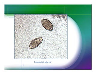 Trichiuris trichiura
10
 