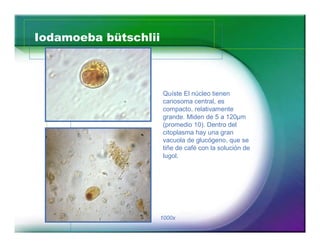 Iodamoeba bütschlii



                      Quíste El núcleo tienen
                      cariosoma central, es
                      compacto, relativamente
                      grande. Miden de 5 a 120µm
                      (promedio 10). Dentro del
                      citoplasma hay una gran
                      vacuola de glucógeno, que se
                      tiñe de café con la solución de
                      lugol.




      29              1000x
 