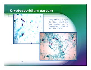 Cryptosporidium parvum

                   Ooquiste de 4 a 6 µm
                   de doble membrana
                   con residuo en el
                   citoplasma. Tinción de
                   KinYoun. 1000x




     38
 