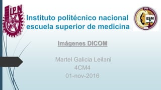 Instituto politécnico nacional
escuela superior de medicina
Imágenes DICOM
Martel Galicia Leilani
4CM4
01-nov-2016
 