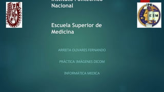 Instituto Politécnico
Nacional
Escuela Superior de
Medicina
ARRIETA OLIVARES FERNANDO
PRÁCTICA: IMÁGENES DICOM
INFORMÁTICA MEDICA
 