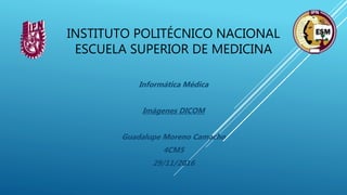 INSTITUTO POLITÉCNICO NACIONAL
ESCUELA SUPERIOR DE MEDICINA
Informática Médica
Imágenes DICOM
Guadalupe Moreno Camacho
4CM5
29/11/2016
 