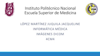 Instituto Politécnico Nacional
Escuela Superior de Medicina
LÓPEZ MARTÍNEZ JUQUILA JACQUELINE
INFORMÁTICA MÉDICA
IMÁGENES DICOM
4CM4
 