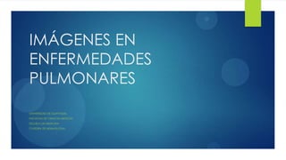 1

IMÁGENES EN
ENFERMEDADES
PULMONARES
UNIVERSIDAD DE GUAYAQUIL
FACULTAD DE CIENCIAS MEDICAS
ESCUELA DE MEDICINA
CATEDRA DE NEUMOLOGIA
 