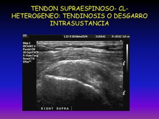 Imagenes En Traumatologia Vicente Aljure Reales PPTX imagenes-en-traumatologia-vicente-aljure-reales-pptx