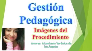 Gestión
Pedagógica
Amores Altamirano Verónica de
los Ángeles
Imágenes del
Procedimiento
 