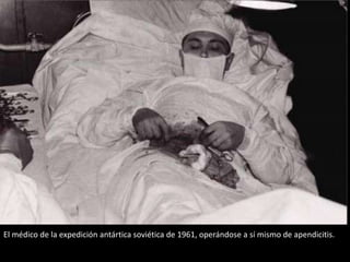 El médico de la expedición antártica soviética de 1961, operándose a sí mismo de apendicitis.

 