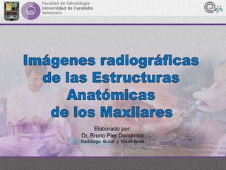 Elaborado por:
Dr. Bruno Pier Doménico
Radiólogo Bucal y Maxilofacial
 