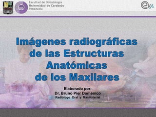 Elaborado por:
Dr. Bruno Pier Doménico
Radiólogo Oral y Maxilofacial
 