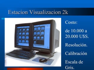 Estacion Visualizacion 2k Costo: de 10.000 a 20.000 U$S. Resolución. Calibración Escala de Gris. 