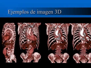 Ejemplos de imagen 3D 