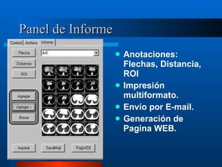 Panel de Informe Anotaciones: Flechas, Distancia, ROI Impresión multiformato. Envío por E-mail. Generación de Pagina WEB. 