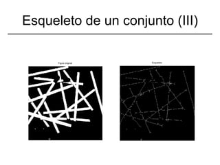 Esqueleto de un conjunto (III) 