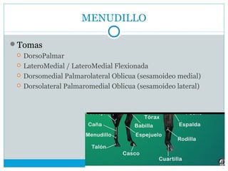 MENUDILLO
Tomas
 DorsoPalmar
 LateroMedial / LateroMedial Flexionada
 Dorsomedial Palmarolateral Oblicua (sesamoideo medial)
 Dorsolateral Palmaromedial Oblicua (sesamoideo lateral)
 