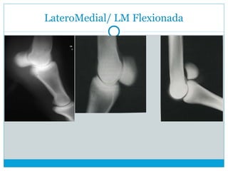 LateroMedial/ LM Flexionada
 
