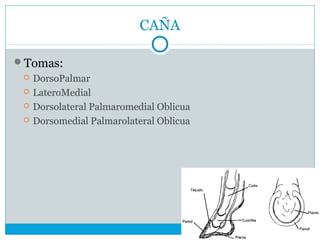 CAÑA
Tomas:
 DorsoPalmar
 LateroMedial
 Dorsolateral Palmaromedial Oblicua
 Dorsomedial Palmarolateral Oblicua
 