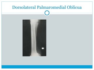 Dorsolateral Palmaromedial Oblicua
 