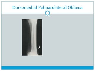 Dorsomedial Palmarolateral Oblicua
 