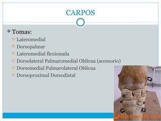 CARPOS
Tomas:
 Lateromedial
 Dorsopalmar
 Lateromedial flexionada
 Dorsolateral Palmaromedial Oblicua (accesorio)
 Dorsomedial Palmarolateral Oblicua
 Dorsoproximal Dorsodistal
 