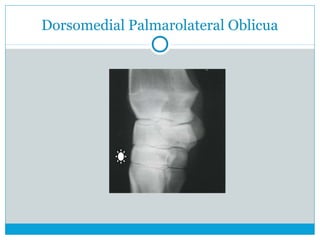 Dorsomedial Palmarolateral Oblicua
 