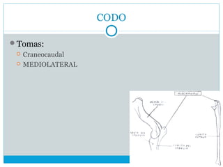 CODO
Tomas:
 Craneocaudal
 MEDIOLATERAL
 