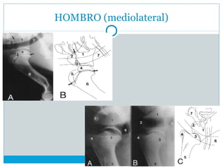 HOMBRO (mediolateral)
 