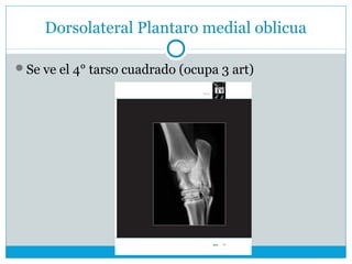 Dorsolateral Plantaro medial oblicua
Se ve el 4° tarso cuadrado (ocupa 3 art)
 