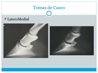 Tomas de Casco
LateroMedial
 