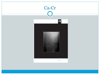 Ca-Cr
 