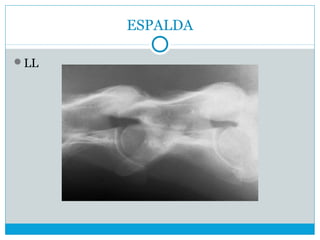 ESPALDA
LL
 