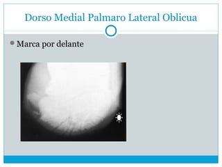 Dorso Medial Palmaro Lateral Oblicua
Marca por delante
 
