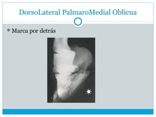 DorsoLateral PalmaroMedial Oblicua
Marca por detrás
 