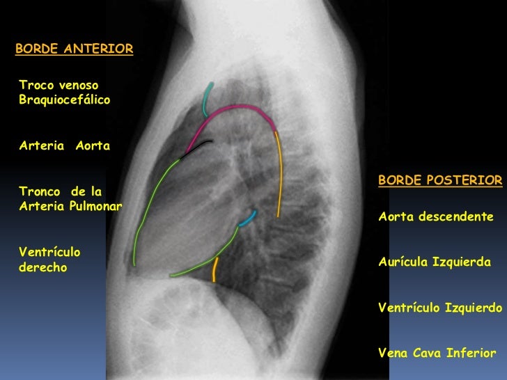 El daño de los ligamentos en sheynom el departamento de la columna vertebral