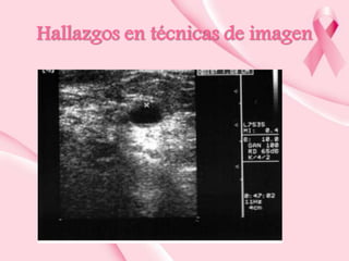 Hallazgos en técnicas de imagen

 