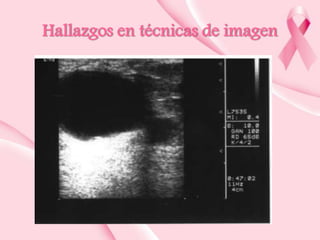Hallazgos en técnicas de imagen

 