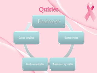 Quistes
Clasificación
Quistes complejos

Quistes complicados

Quistes simples

Microquistes agrupados

 