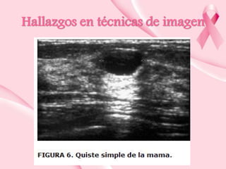 Hallazgos en técnicas de imagen

 