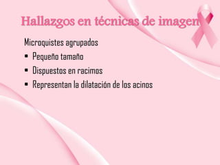 Hallazgos en técnicas de imagen
Microquistes agrupados
• Pequeño tamaño
• Dispuestos en racimos
• Representan la dilatación de los acinos

 