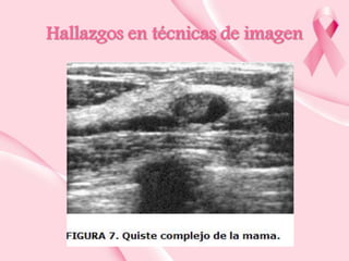 Hallazgos en técnicas de imagen

 