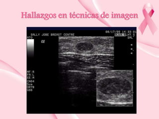 Hallazgos en técnicas de imagen

 