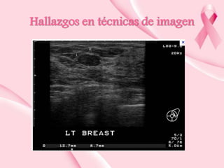 Hallazgos en técnicas de imagen

 