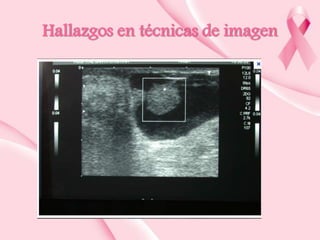 Hallazgos en técnicas de imagen

 