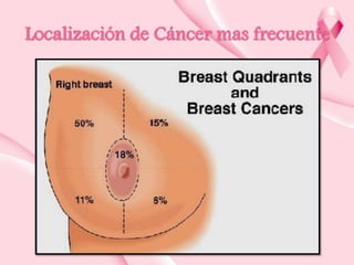 Localización de Cáncer mas frecuente

 