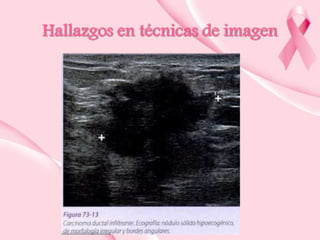 Hallazgos en técnicas de imagen

 